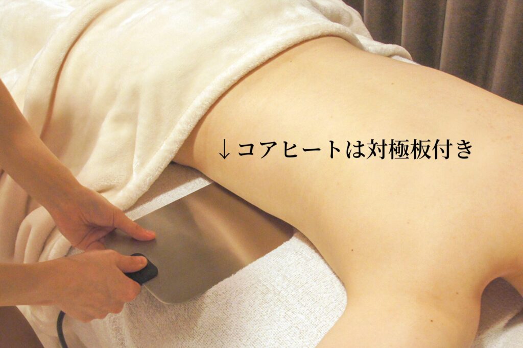 コアヒートは対極板付きラジオ波施術